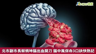 腦中風可分為出血性、缺血性等兩大類，前者就是俗稱的「腦出血」，占比約2成。（圖／NOW健康製作；圖片來源／ingimage）