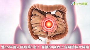 大腸癌連續蟬聯國人癌症排行榜中冠軍15年，醫師提醒50歲以上民眾務必定期接受糞便潛血檢查。（圖／NOW健康製作；圖片來源／ingimage）