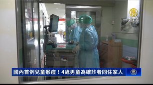 國內首例兒童猴痘！4歲男童為確診者同住家人