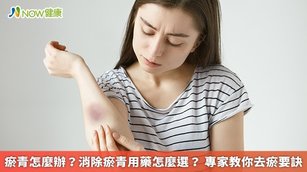 瘀青怎麼辦？消除瘀青用藥怎麼選？專家教你去瘀要訣(首圖來源／Freepik)